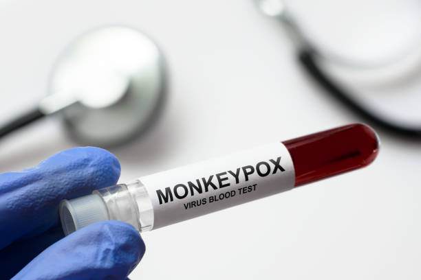 Monkeypox test tube in doctors hand stock photo