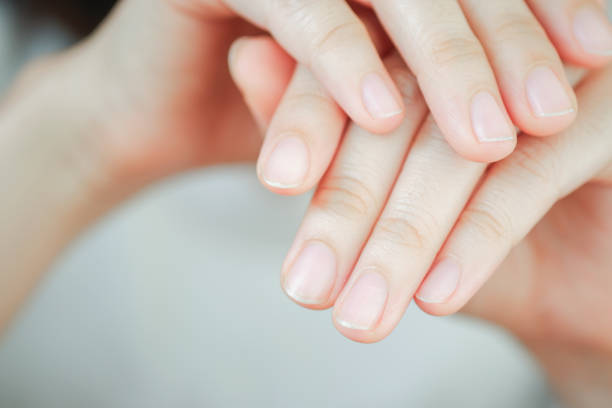 istock Close-up of woman's fingernail. Hand concept. 1401491291