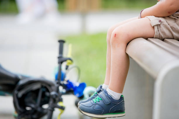 istock Blond child, cute boy with wounded knee from a fall 1401531060