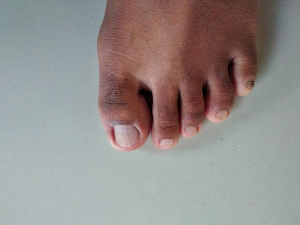 istock Close-up foot of human 1401675881
