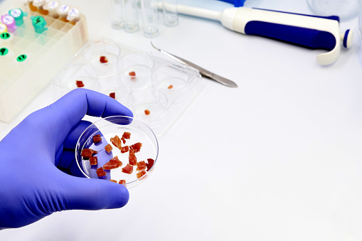 A scientist is holding a Petri dish with pieces of raw cultured meat in the biotechnology laboratory, Synthetic production, or laboratory-grown meat concept.  Copy space.