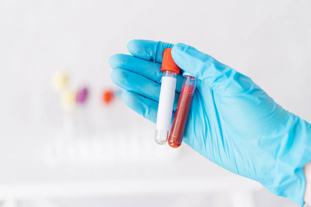Hand holding two empty test tubes against the background of vials stock photo