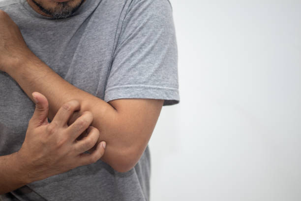 istock Skin disease concept, itching, scratching the arm 1401758989