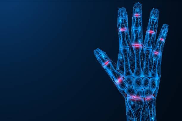 Inflammation and pain in the joints of the hand. Inflammation and pain in the joints of the hand. Polygonal design of interconnected lines and points. Blue background. rheumatoid arthritis stock illustrations