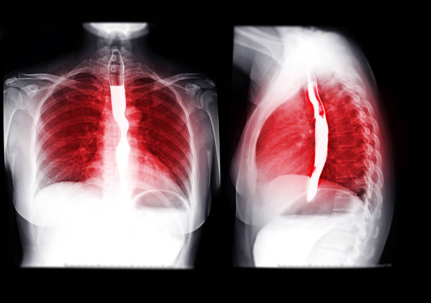 食堂のコレクション。 - barium ストックフォトと画像