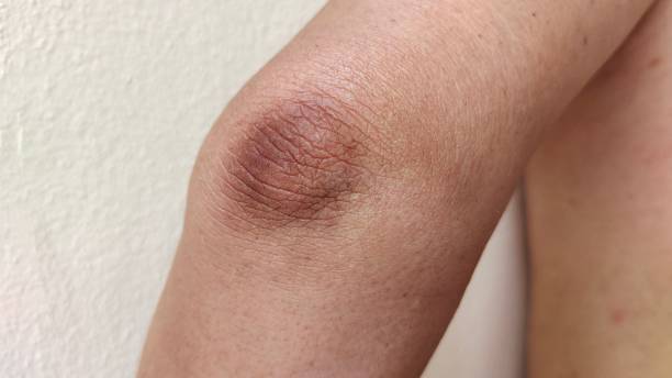 istock Crook and black elbow 1401860092