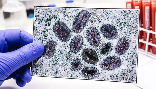 猿痘ワクチンを装着したラテックス手袋をはめた薬剤師の手、背景に天然痘ウイルスの写真 - influenza a virus ストックフォトと画像