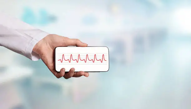 Photo of Heartbeat cardiogram on smartphone screen display in doctor hand against blurred hospital background