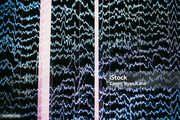 Brainwaves Imaged In Neurofeedback Treatment Stock Photo - Download Image Now - Brain Wave, Medical Scan, Inspiration