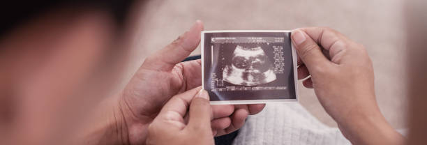 asijská nebo kavkazská těhotná žena a manžel drží ultrazvukový 4d skenovací obraz, očekávání dítěte a mateřská prenatální péče. rodičovství, spojení dohromady, banner konceptu těhotenství ženy - nemocnice fotky - stock snímky, obrázky a fotky