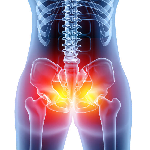 Bones of the pelvis and hip, human anatomy, femur bone joint pain, X ray of the hip joint and femur. 3d illustration Bones of the pelvis and hip, human anatomy, femur bone joint pain, X ray of the hip joint and femur. 3d illustration Pelvis stock pictures, royalty-free photos & images