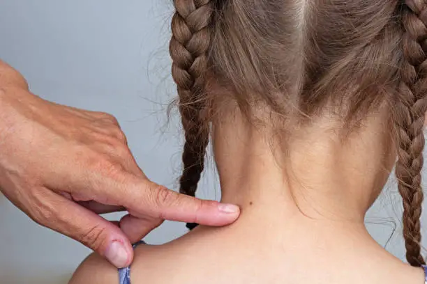 Adult finger showing birthmark on child neck back on white background