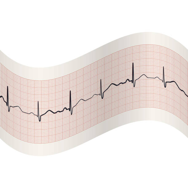 Ecg Paper Pattern 40+ Ecg Graph Paper Stock Illustrations, Royalty-Free Vector Graphics ...