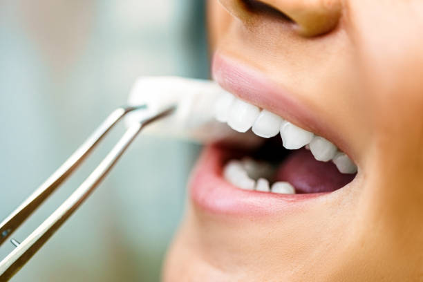 istock Dentist putting cotton in woman's mouth 1402315933