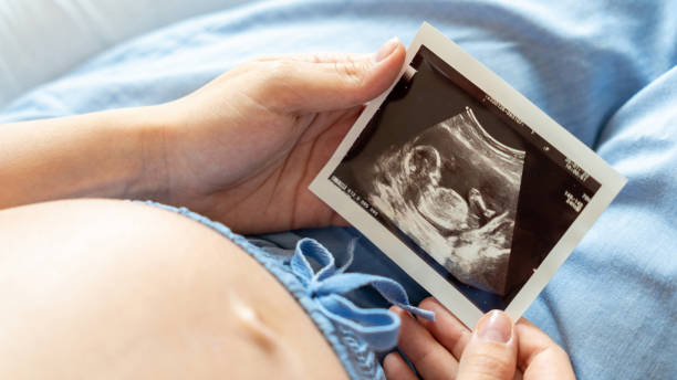 Ultrasound picture pregnant baby photo. Woman holding ultrasound pregnancy image. Concept of pregnancy, maternity, expectation for baby birth. Ultrasound picture pregnant baby photo. Woman holding ultrasound pregnancy image. Concept of pregnancy, maternity, expectation for baby birth first ultrasound stock pictures, royalty-free photos & images