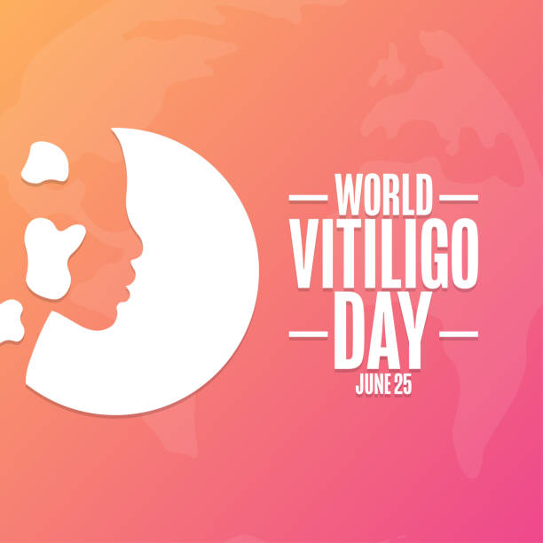 World Vitiligo Day. June 25. Holiday concept. Template for background, banner, card, poster with text inscription. Vector EPS10 illustration. World Vitiligo Day. June 25. Holiday concept. Template for background, banner, card, poster with text inscription. Vector EPS10 illustration vitiligo stock illustrations