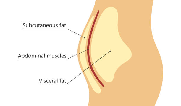 illustrazioni stock, clip art, cartoni animati e icone di tendenza di grasso viscerale e sottocutaneo intorno alla vita. posizione del grasso viscerale nella cavità addominale. tipi di obesità umana. schema medico. illustrazione vettoriale isolata su sfondo bianco - insulin resistance