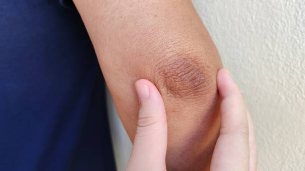 istock Crook of the arm, black elbow. 1402635029