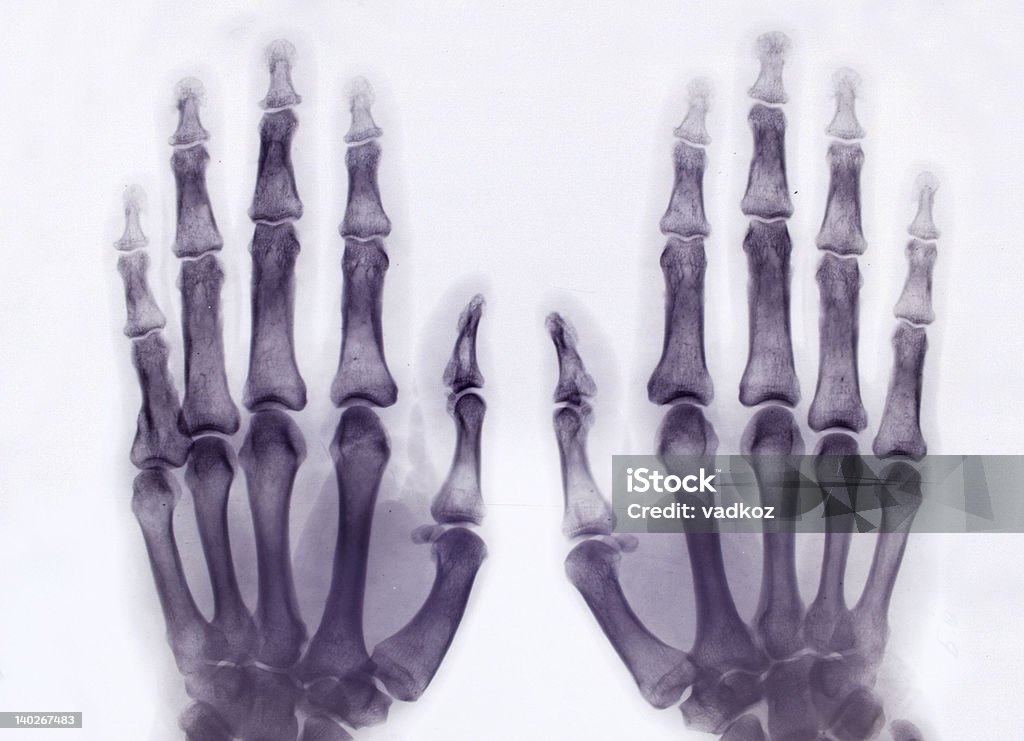 x-ray Bilder - Lizenzfrei Anatomie Stock-Foto