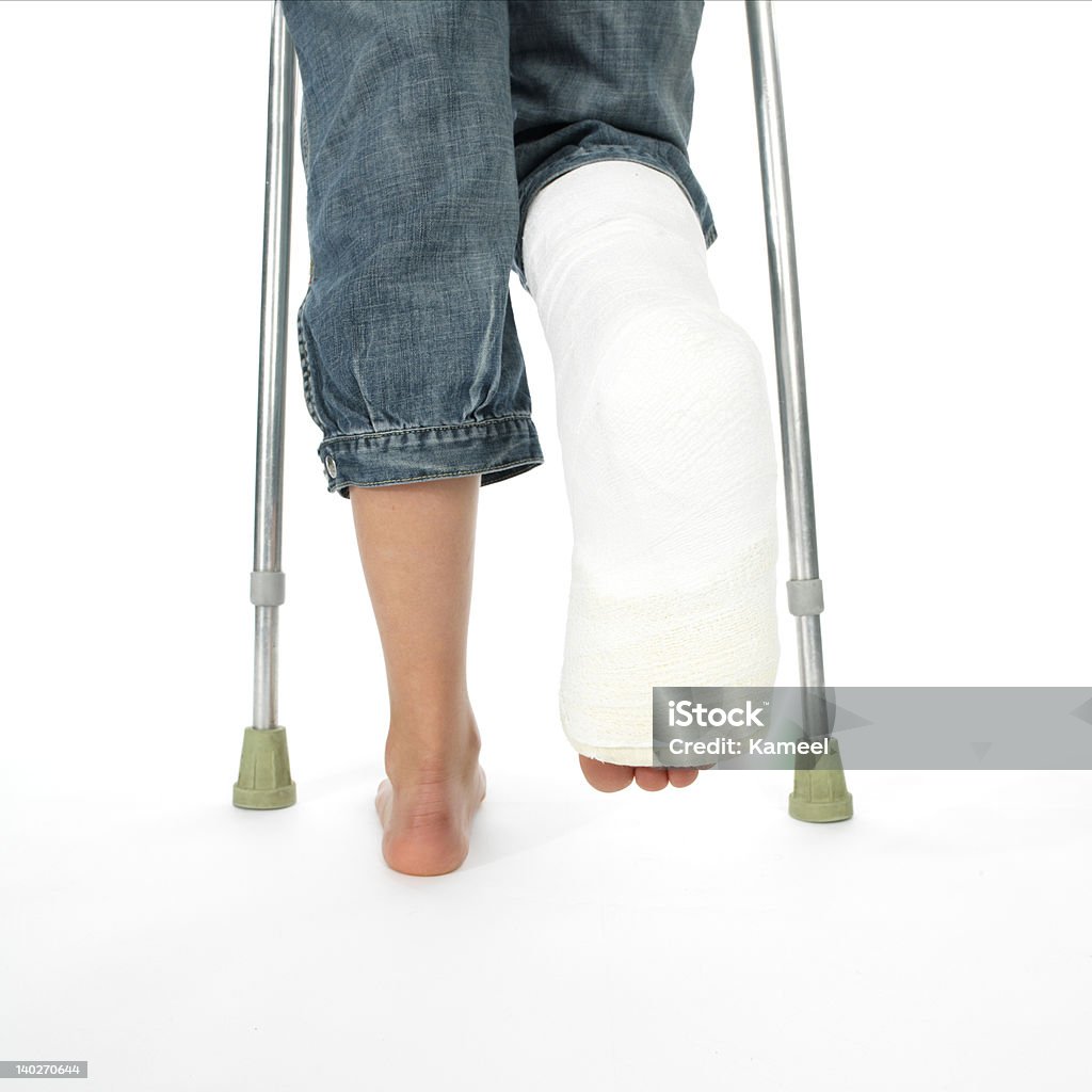 Девушка с Сломанная нога - Стоковые фото Гипсовая повязка роялти-фри