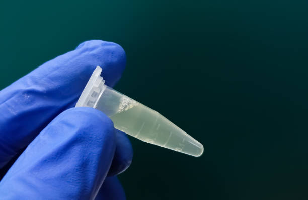 Eppendorf Tube with Cerebrospinal fluid (CSF) sample for pathological study including biochemistry, cytology, Gram staining. stock photo