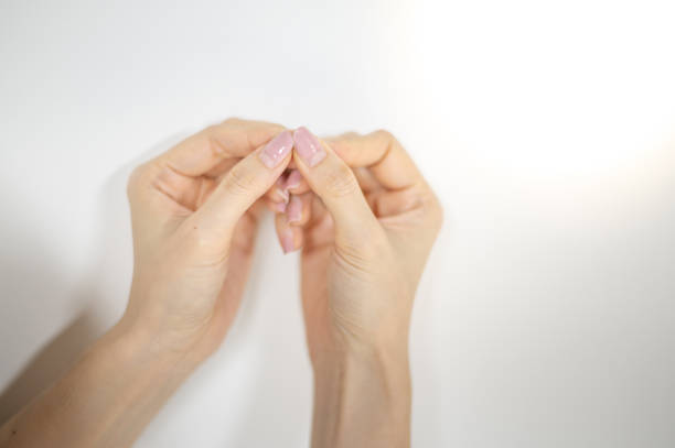 Female nail weakness damage from gel polish coating, Fingernail manicure. stock photo