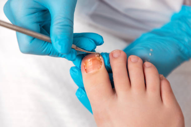 a pedicurist does a pedicure for the client's feet, cleaning the nails with a double-sided curette. close up, top view. the concept of salon professional nail care and chiropody - podiatrist customer service beauty spa imagens e fotografias de stock
