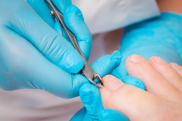 a chiropodist in blue medicine gloves gives a pedicure to the client's foot, cutting dry skin with clippers. close up. the concept of salon foot care - podiatrist podiatry pedicure chiropodist imagens e fotografias de stock