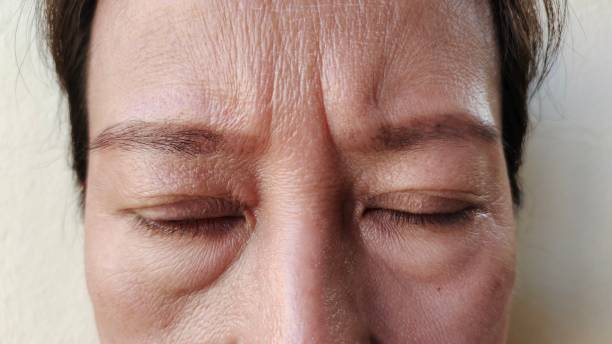 flabbiness and wrinkle on the forehead lines - ogen dicht closeup vrouw 50 jaar stockfoto's en -beelden