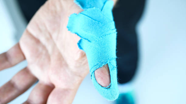 istock Man showing kinesiology taping on his thumb 1402841366