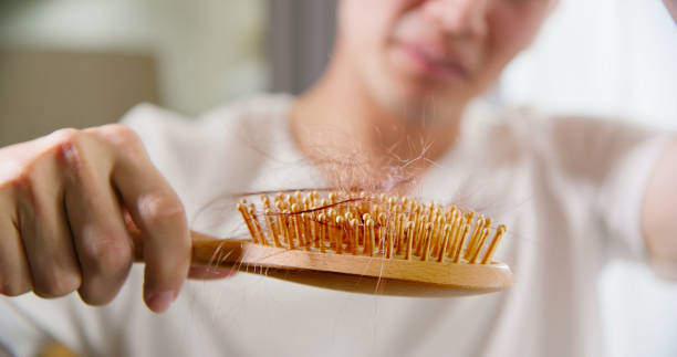 man worried about hair loss - east asian ethnicity japanese ethnicity asian ethnicity one person imagens e fotografias de stock