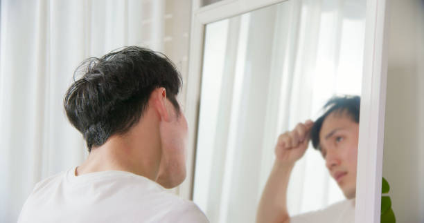 man worried about hair loss - east asian ethnicity imagens e fotografias de stock
