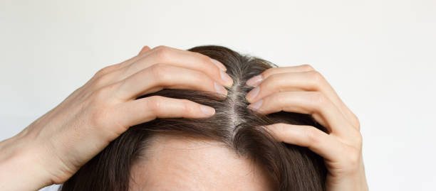 una mujer de mediana edad muestra raíces de cabello gris. - white hair fotografías e imágenes de stock