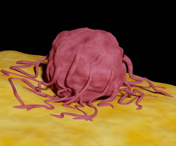 istock A tumor is uncontrolled growth occurs in solid tissue as a cancer cell 1403050522