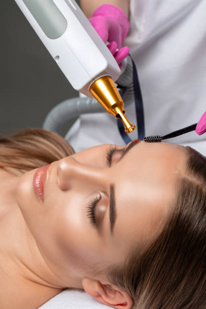 istock Removal of permanent makeup on the eyebrows.Carbon face peeling in a beauty salon. Hardware cosmetology treatment. 1403125094