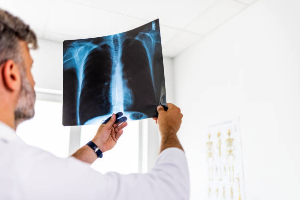istock Radiologist Examining Chest X-Ray In Hospital 1403226791
