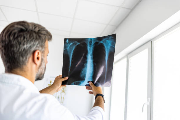 istock Radiologist Examining Chest X-Ray In Hospital 1403226795