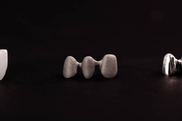 istock Teeth implant and crown installation process parts isolated on a black background. Medically accurate 3D model. 1403267918
