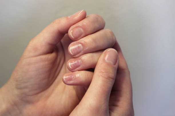 istock cuticle removal manicure at home 1403268955