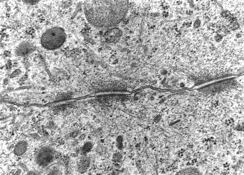 Transmission electron micrograph (TEM) showing a desmosome (macula adherens) with prominent dense plaques where keratin intermediate filaments were attached.