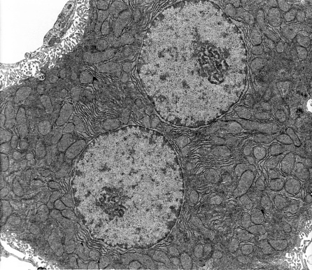 TEM micrograph showing a binucleated hepatocyte. The cytoplasm shows many mitochondria and elongated cisterns of rough endoplasmic reticulum (RER). In three micrograph corners, the space of Disse with many microvilli can be seen