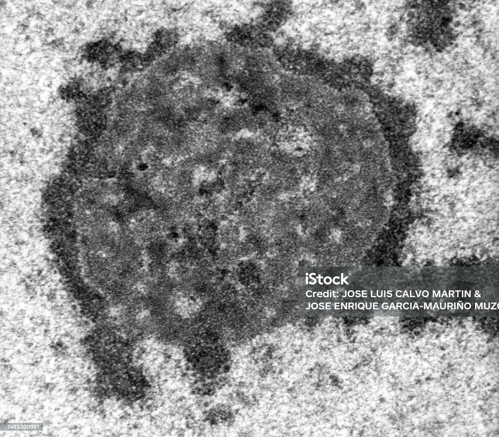 Granular Components Nucleolus Tem Micrograph Stock Photo - Download Image Now - Biological ...