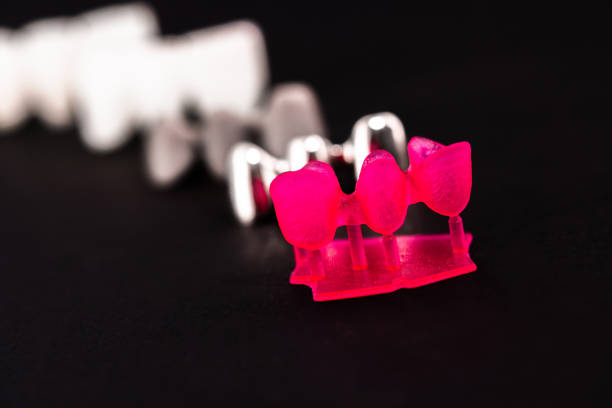 istock Teeth implant and crown installation process parts isolated on a black background. Medically accurate 3D model. 1403314821