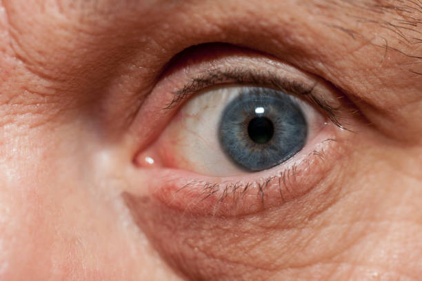 istock blue eye of man 1403331319