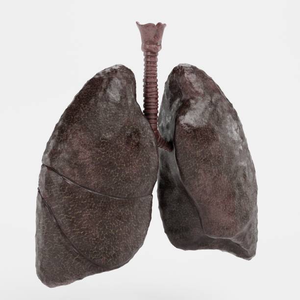 istock Realistic 3D Render of Smoker Lungs 1403431302