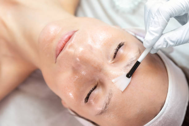 close-up beautician doctor hand making anti-age procedure apply peeling acid young attractive female client at beauty clinic. cosmetologist specialist doing skincare treatment. health care therapy - masker stockfoto's en -beelden