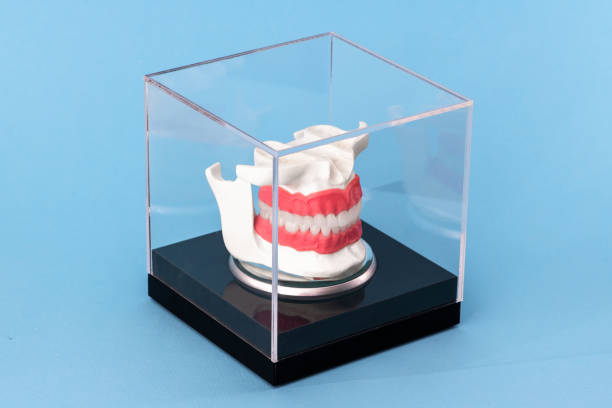 istock Human jaw with teeth implants anatomy model isolated on blue background in a glass box. 1403540495