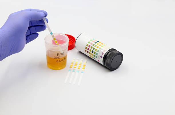 istock Performing a strip of urine test 1403659885