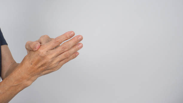 istock Senior or older woman hand that had arthritis or trigger fingers on white background. 1403664426