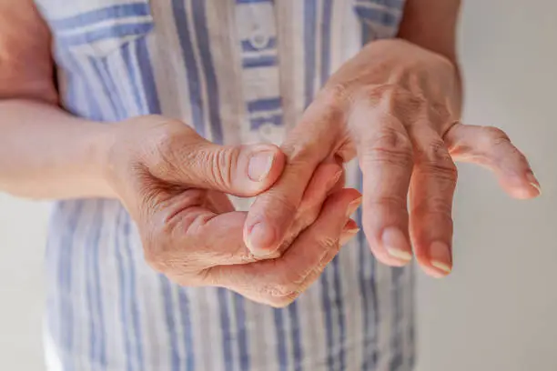 Close-up of woman's hands with neurological disease, arthritis, numbness. The old man gives himself a massage rubs the ointment into his joints. The concept of age-related changes, parkinson's disease